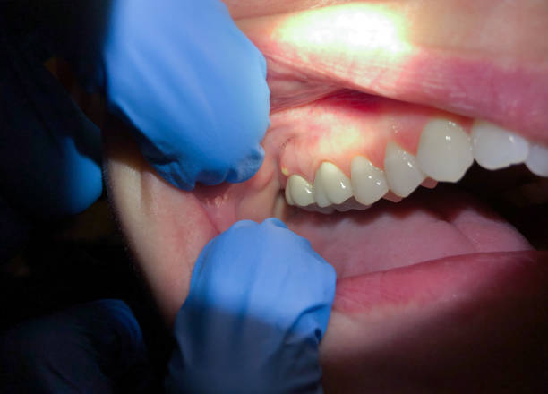 Best Pediatric Emergency Dentist in Carmi, IL